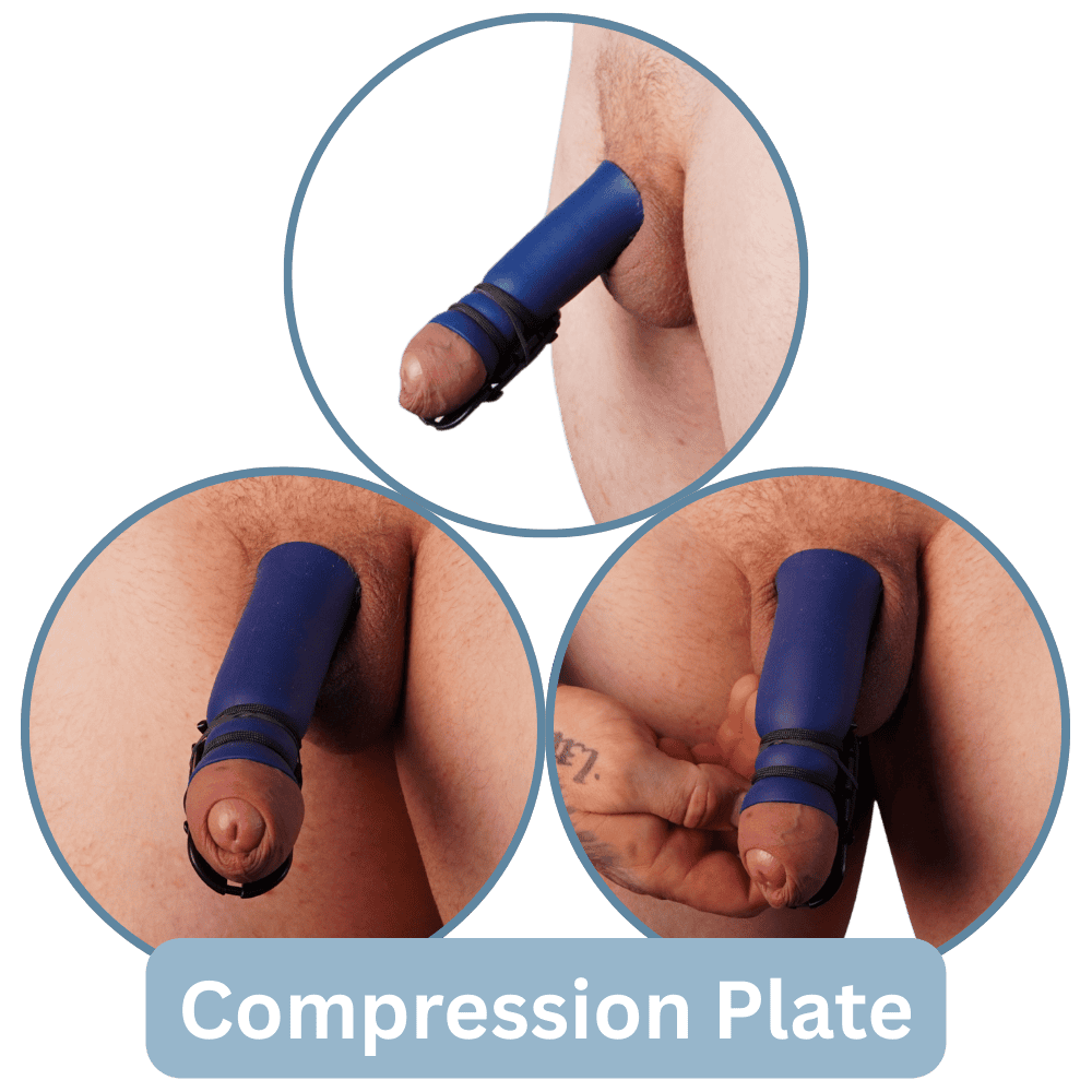 Passive Healing Sleeve Kit