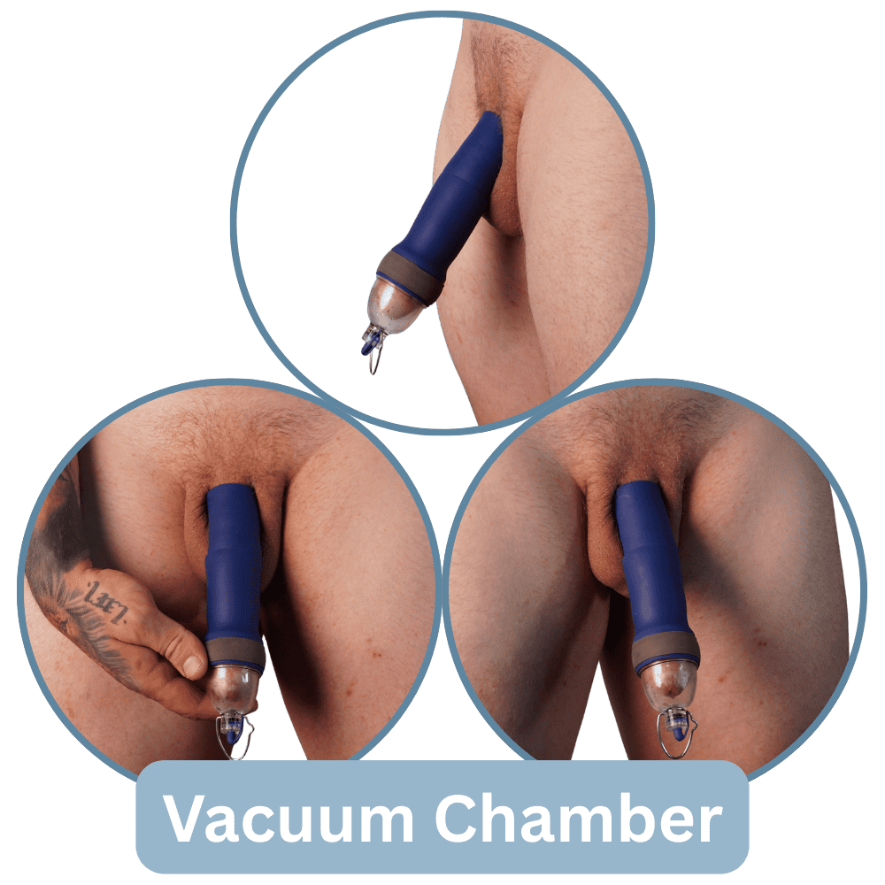 Passive Healing Sleeve Kit