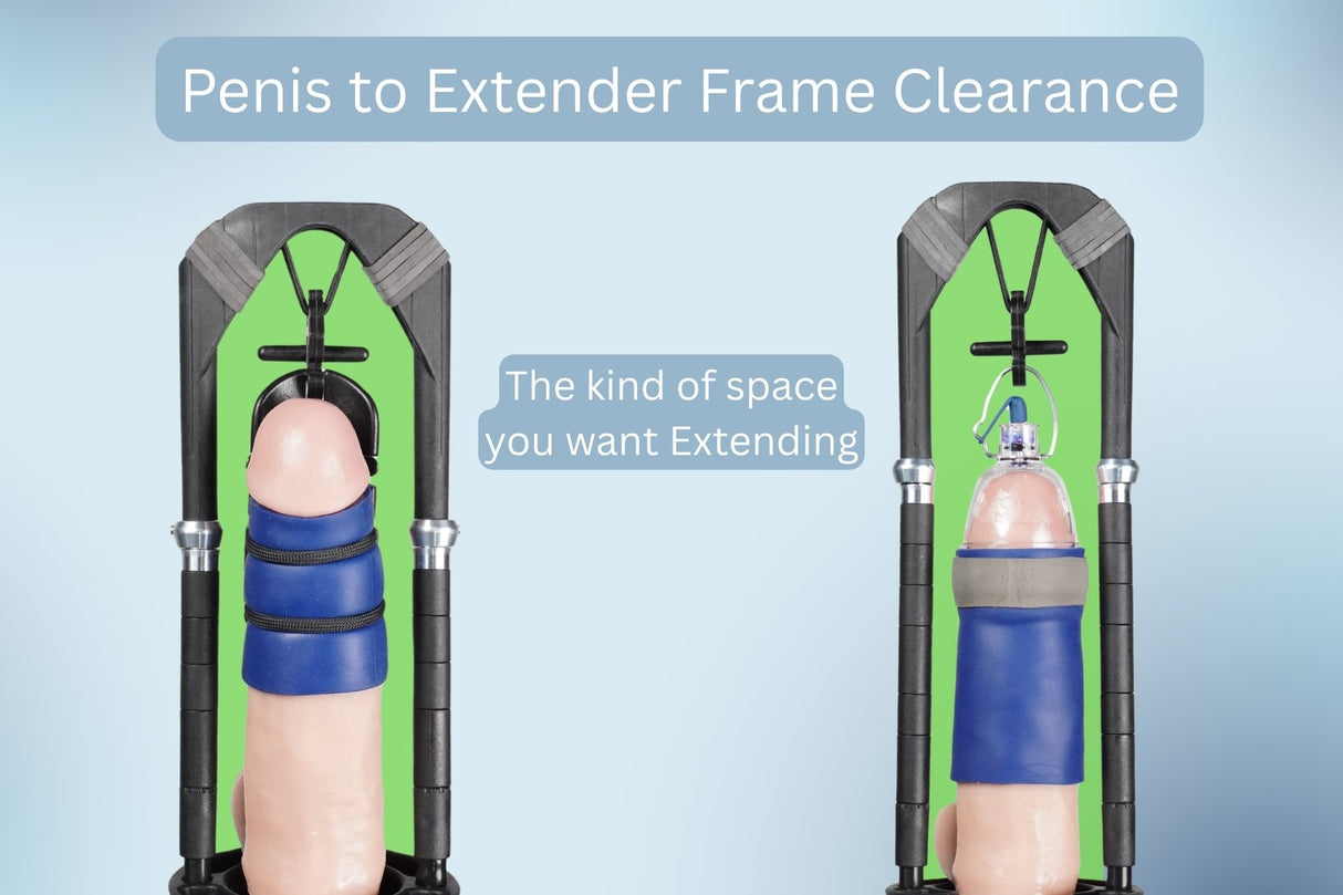 Total Man Extender Kit